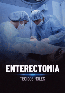 Enterectomia