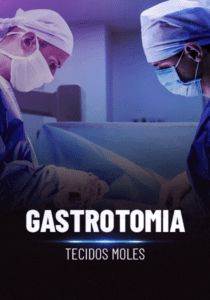 Gastrotomia_