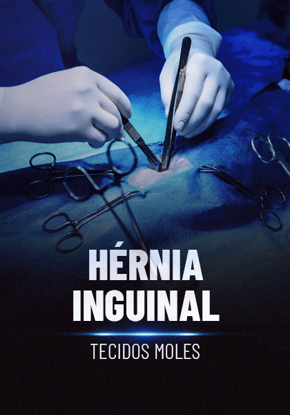 Hernia-inguinal_.png