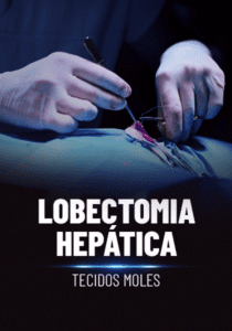 Lobectomia hepática