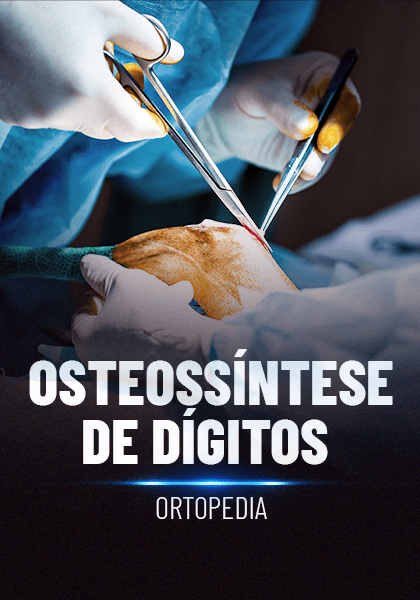 Osteossíntese de dígitos_