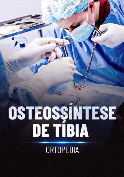 Osteossíntese de tíbia_