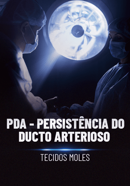 PDA-Persistencia-do-Ducto-Arterioso_.png