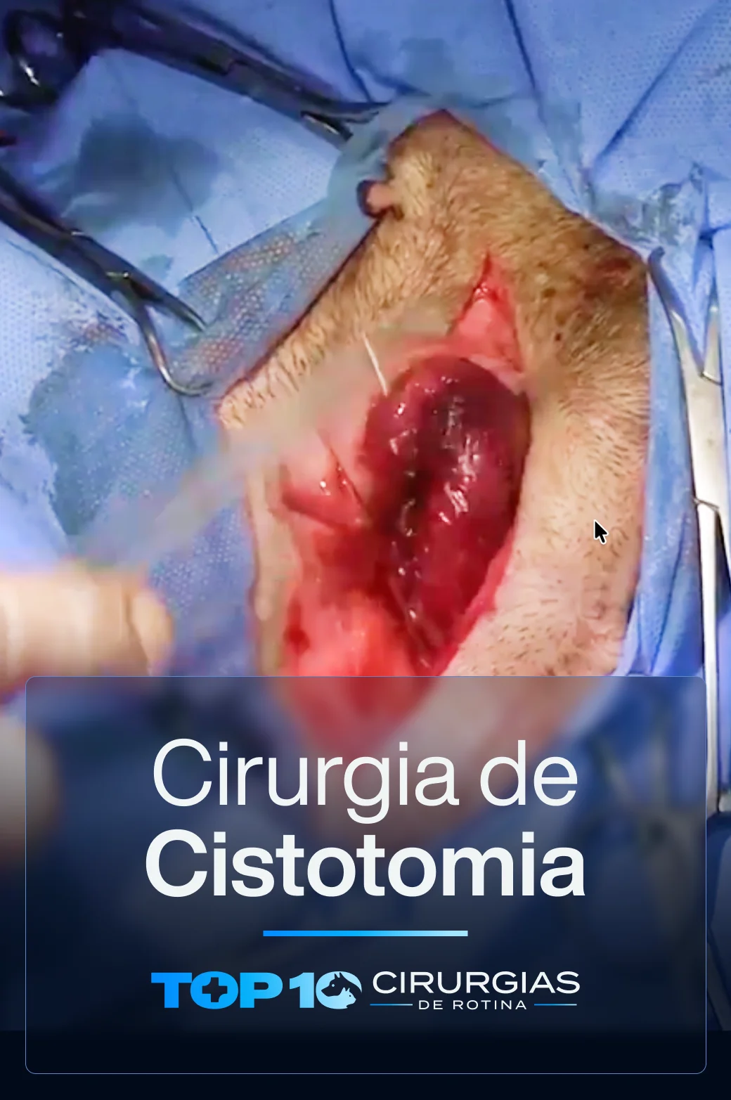 CAPA-TOP10-Cistotomia