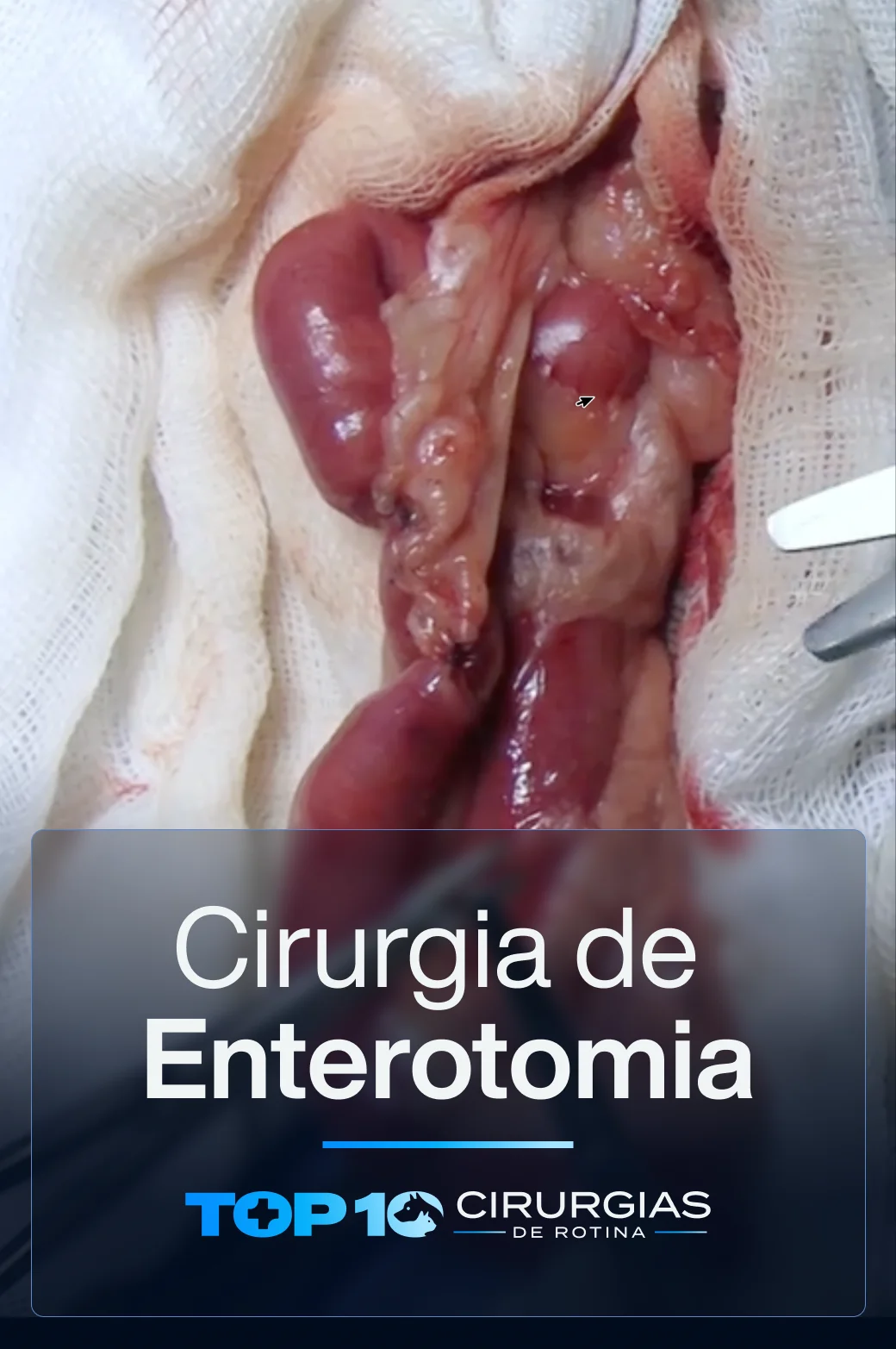 CAPA-TOP10-Enterotomia