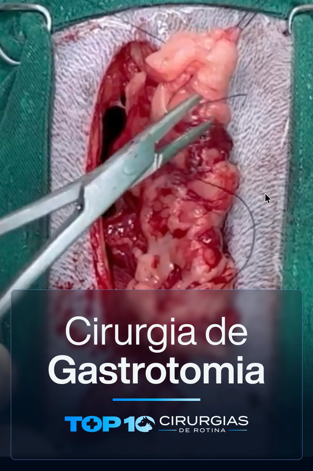 CAPA-TOP10-Gastrotomia