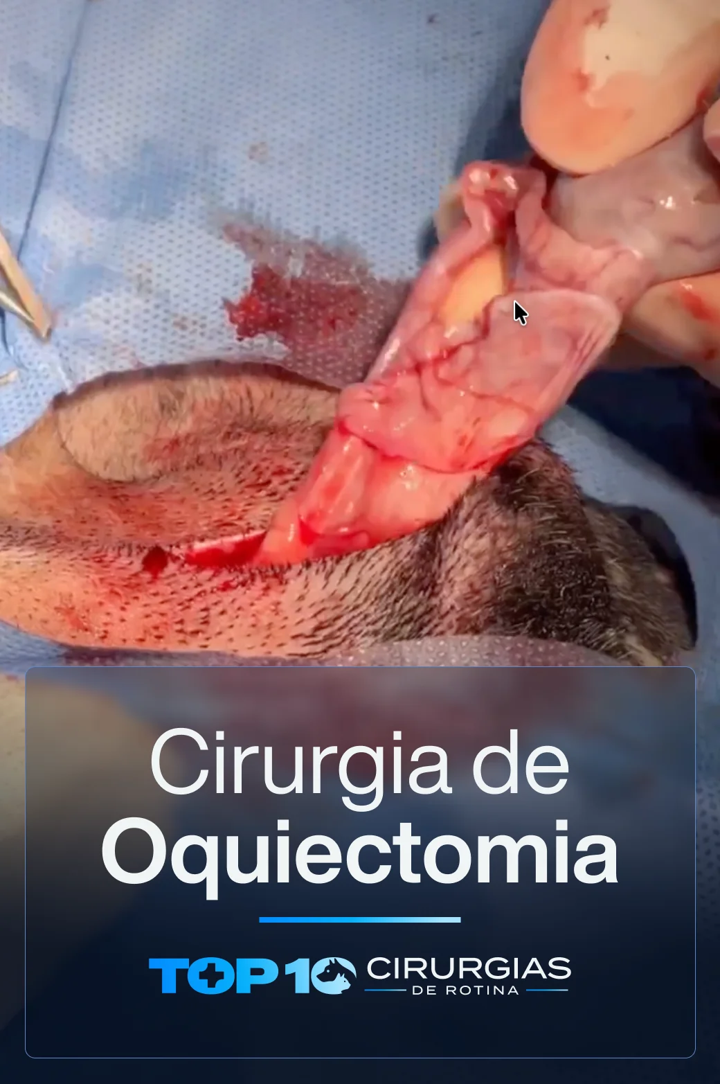 CAPA-TOP10-OQUIECTOMIA