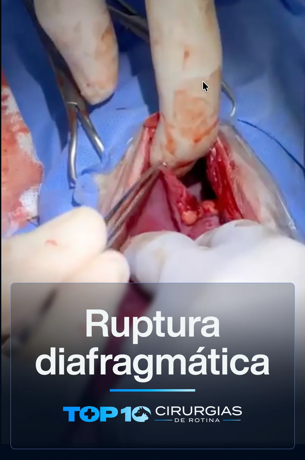 CAPA-TOP10-Ruptura-1